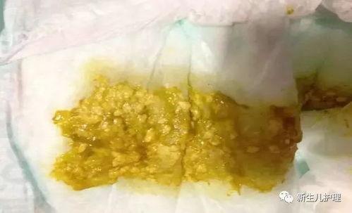 宝宝吃贝贝瓜便秘,贝贝瓜助力宝宝缓解便秘困扰-第1张图片-51吃瓜官网-51黑料平台